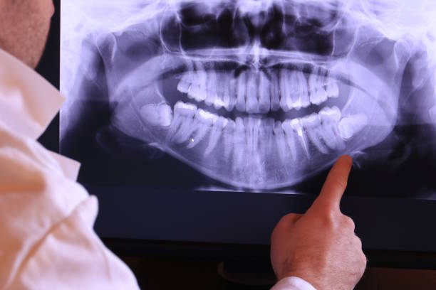 Best Emergency Cosmetic Dentistry in League City, TX
