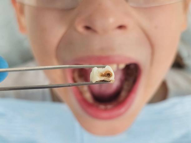 Best Weekend Emergency Dentist in League City, TX