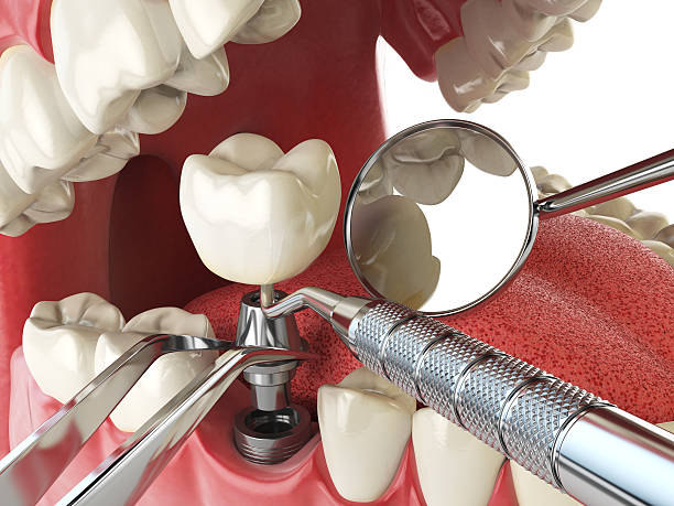 Best Mobile Emergency Dentist in League City, TX